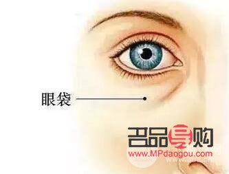 内切眼袋需要拆线吗(内切眼袋需要拆线吗图片)