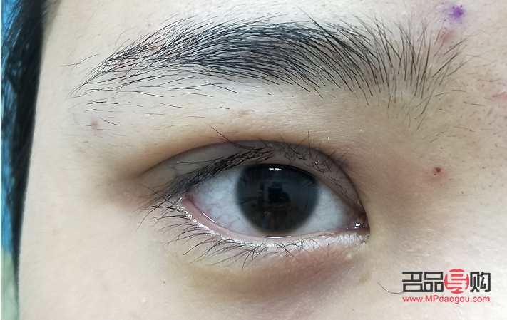 <h3>全切双眼皮：塑造迷人电眼的秘密武器</h3>