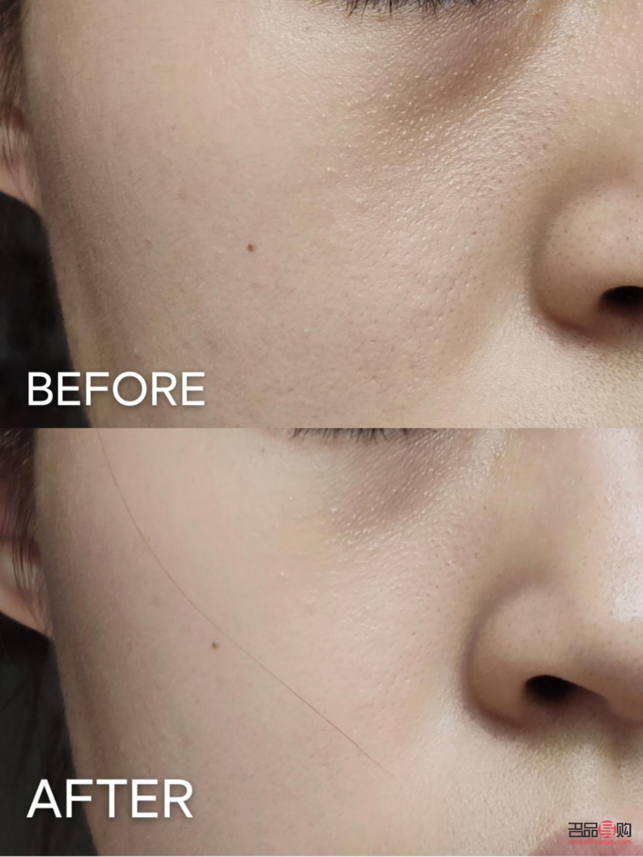 美容仪怎么选(美容仪怎么选择)