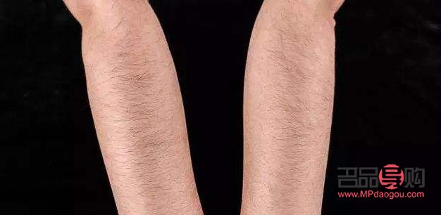 身体四种毛发怎么护理(身体四种毛发怎么护理的)