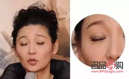 大眼综合与小眼综合:眼部整形手术的不同选择 大眼综合与小眼综合:眼部整形手术的不同选择