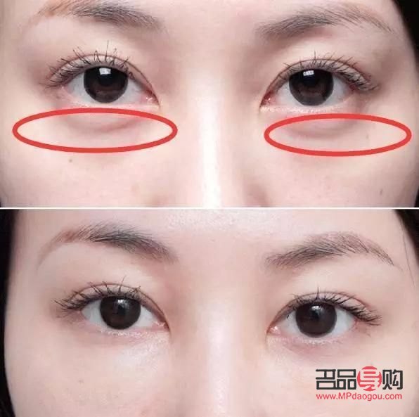 小孩眼袋是怎样产生的如何消除(小孩眼袋是怎样产生的,如何消除)