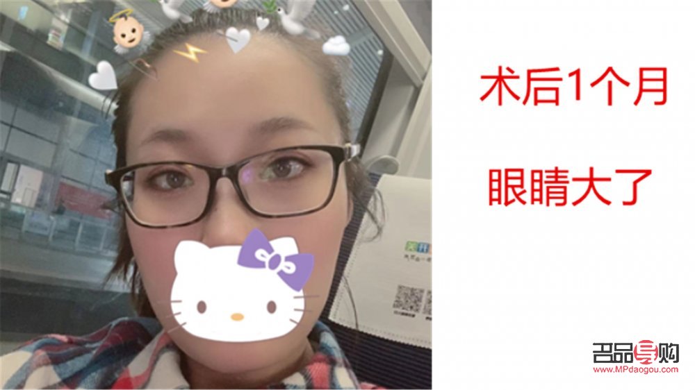 <h3>天生眼泡肿怎么办？有效缓解眼泡肿胀的方法与建议</h3>