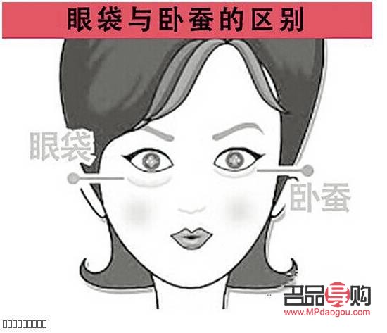 如何准确区分眼袋与卧蚕？图片对比解析