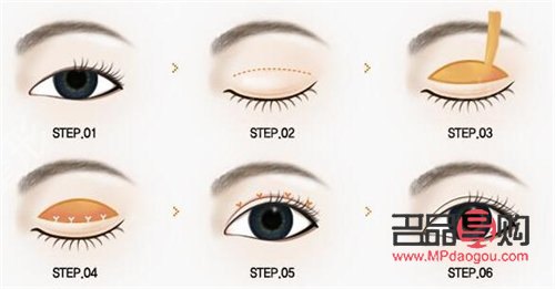 <h3>重塑青春明眸：探索眼皮下垂恢复之道</h3>