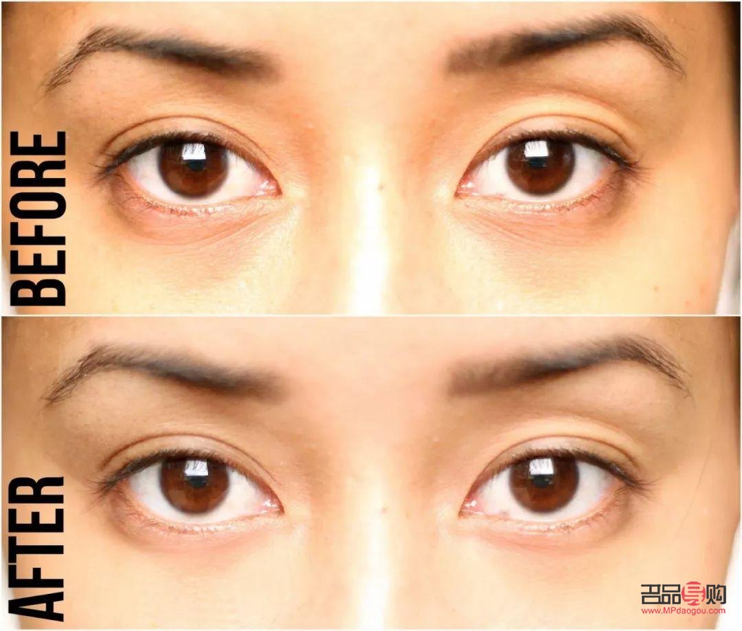 消除肿眼泡的眼霜(消除肿眼泡的眼霜有用吗)