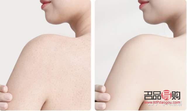 <h3>身体护理是否需要脱衣服？</h3>