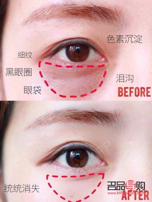 泪沟化妆技巧：如何巧妙遮住眼袋