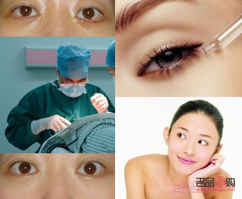 眼袋抽脂手术视频(割眼袋视频过程高清图片)