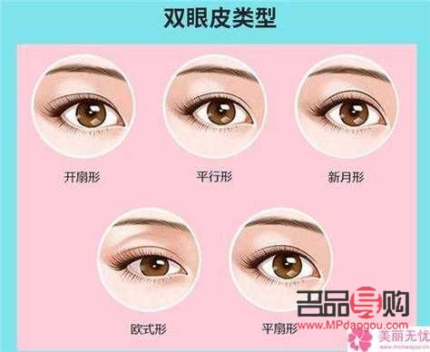 双眼皮手术能否二次操作及费用探讨