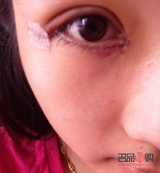 微创双眼皮多久可以恢复自然眼皮(微创双眼皮多久可以恢复自然眼皮了) 微创双眼皮多久可以恢复自然眼皮(微创双眼皮多久可以恢复自然眼皮了)