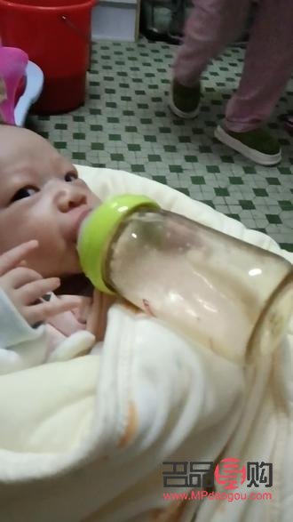 一觉醒来三眼皮怎么恢复双眼皮(一觉醒来变三眼皮迅速恢复双眼皮)