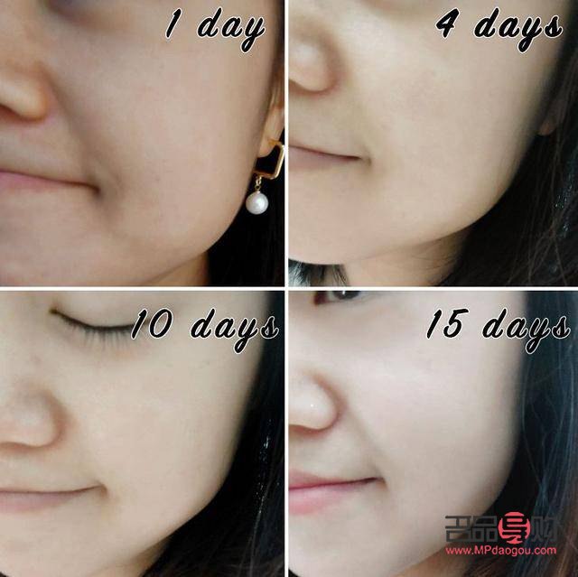 <h3>常做美容，脸皮会变薄吗？</h3>