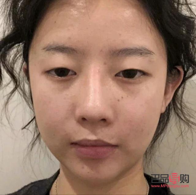 双眼皮有几种类型图片大全集(双眼皮有几种类型图片大全集图解)