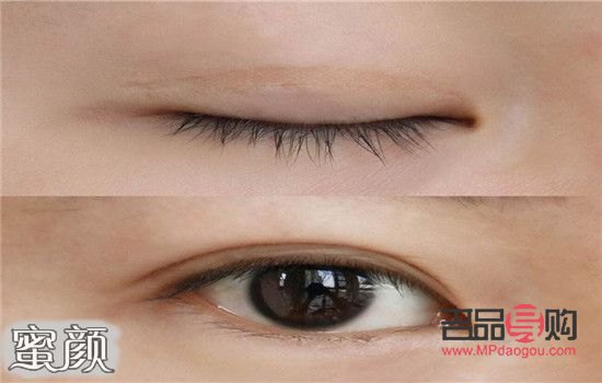 双眼皮褶皱位置变了怎么变回来(双眼皮褶皱变了怎么办)