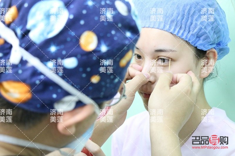 眼综合有哪几种眼型(眼综合类型有哪些)