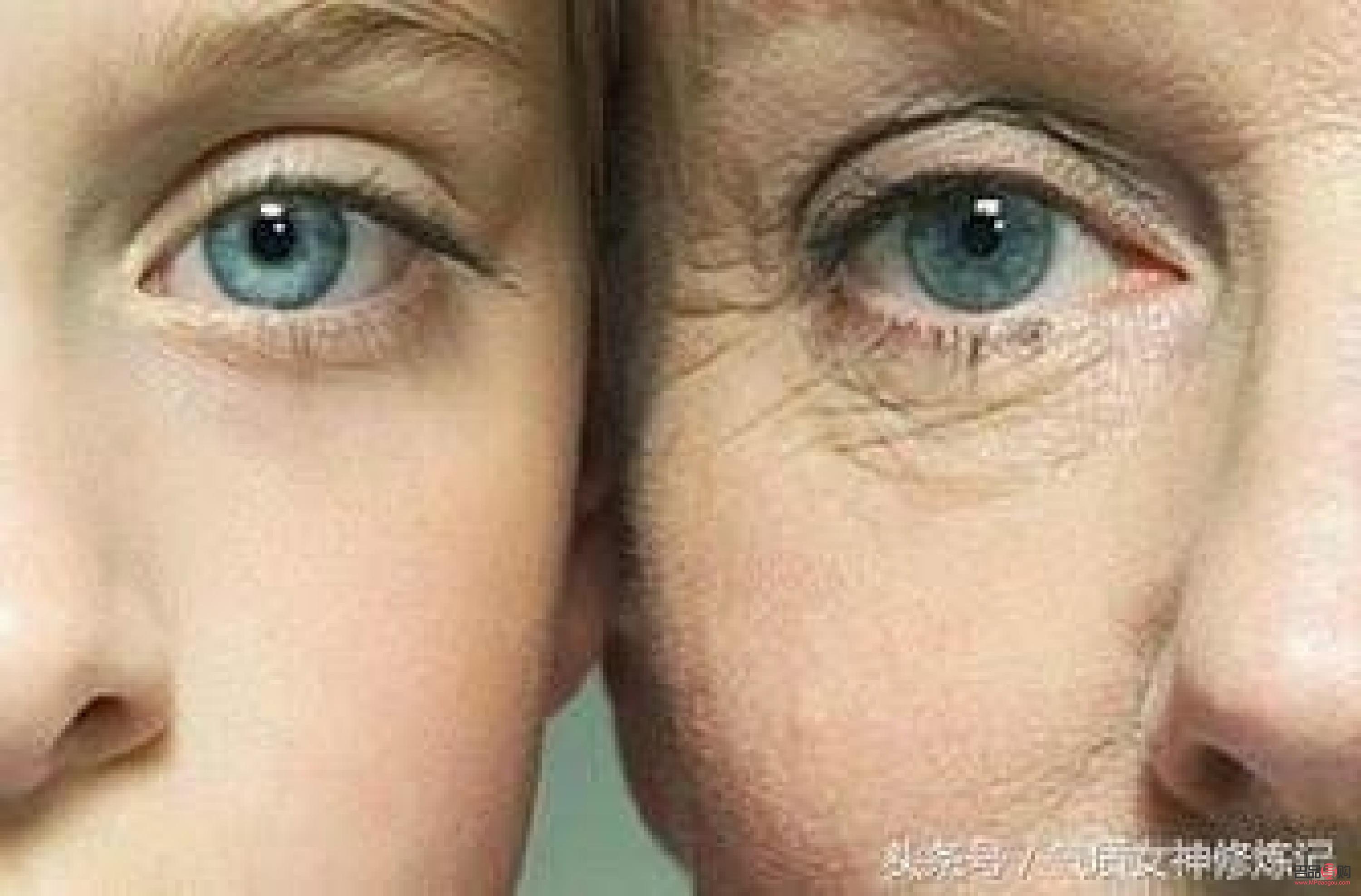 眼部皱纹消除最好方法视频(眼部皱纹消除最好方法视频讲解) 眼部皱纹消除最好方法视频(眼部皱纹消除最好方法视频讲解)