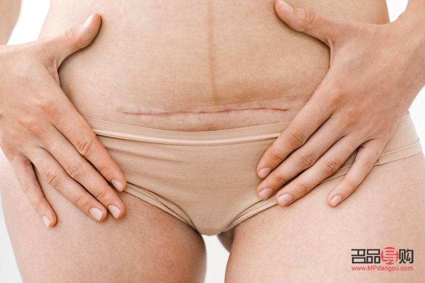 剖腹产前怎么护理身体(剖腹产前怎么护理身体好)