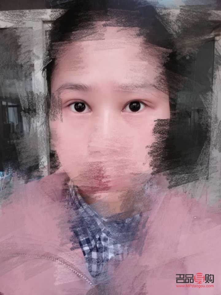 <h3>如何矫正一个眼大一个眼小的问题</h3>