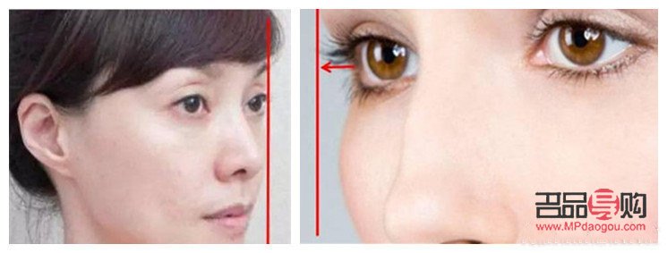哪种割双眼皮最自然的(哪种割双眼皮最自然的图片)