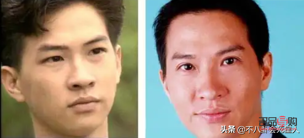 哪种割双眼皮最自然的(哪种割双眼皮最自然的图片)