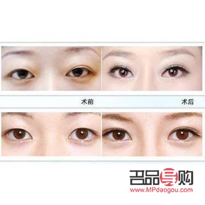 韩式翘睫双眼皮(韩式翘睫双眼皮的做法)