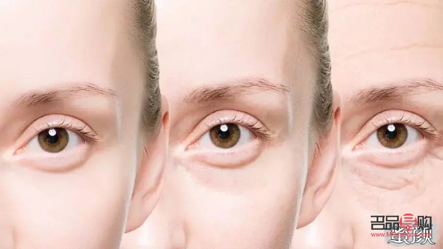 眼部抗衰的原理及作用(眼部抗衰的原理及作用是什么)