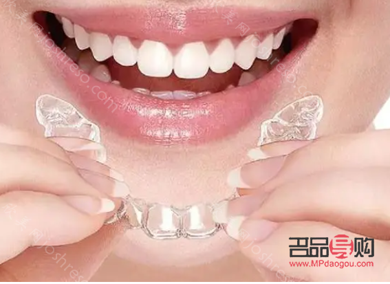 美容牙套多少钱(美容牙套多少钱一个)