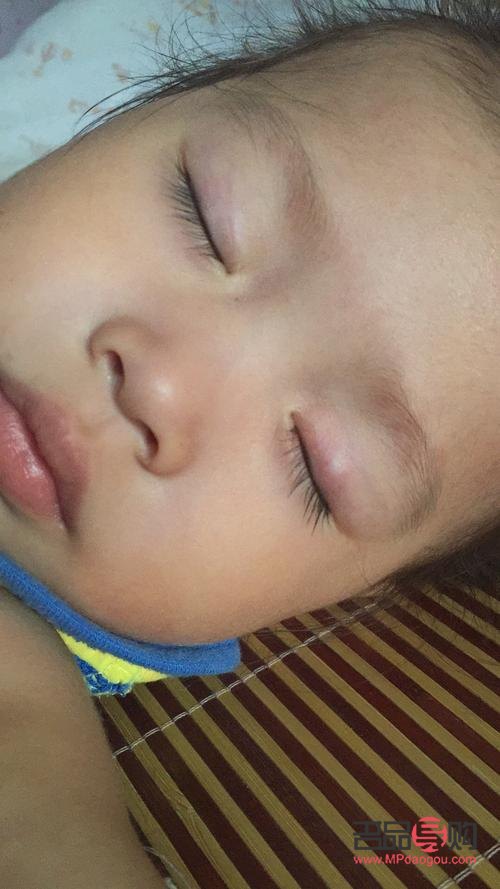 小孩子眼睛下面肿是怎么回事(小孩子眼睛下面肿是怎么回事儿)