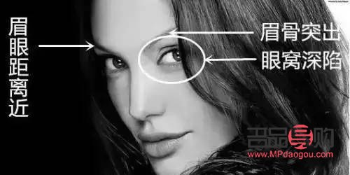 眼睛凹陷是什么原因怎么恢复(眼睛凹陷是什么原因怎么恢复正常)