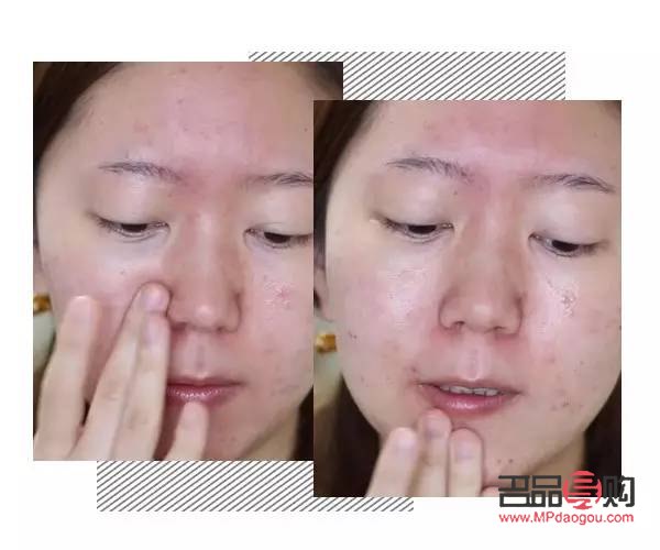 痘肌彩妆怎么选(痘肌彩妆怎么选颜色)