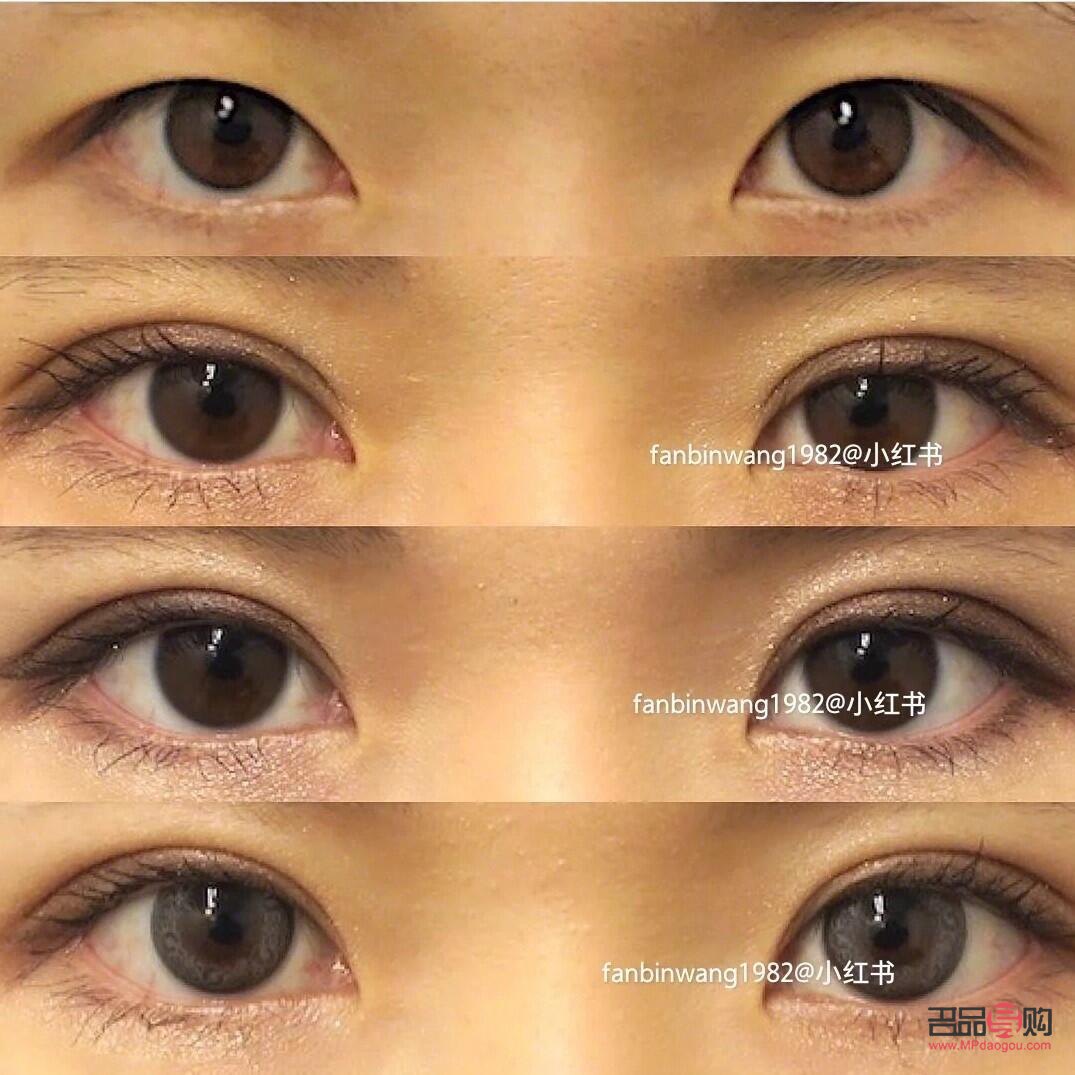双眼皮大小眼怎么改善(双眼皮大小眼怎么改善图片)