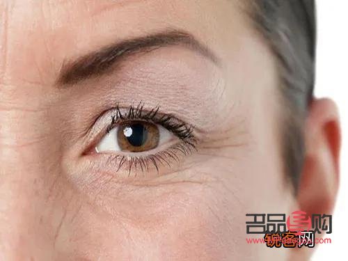 眼睛下面干纹越来越多怎么办(眼下已经形成的干纹怎么去除)