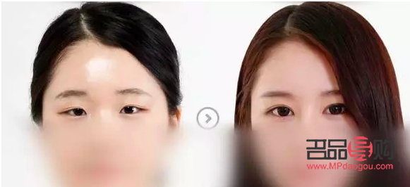 如何改善大小眼问题(如何改善大小眼问题的方法)