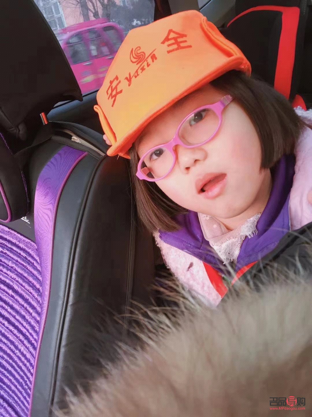 眼睛近视了怎样才能恢复不戴眼镜