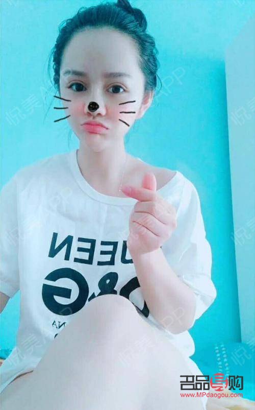 大综合和小综合双眼皮的区别(大综合和小综合双眼皮的区别图片)