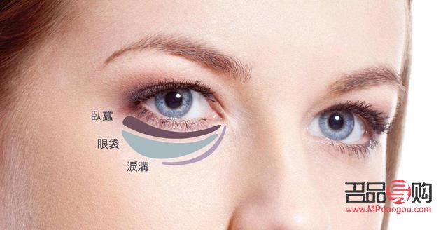 Fotona去眼袋效果深度解析