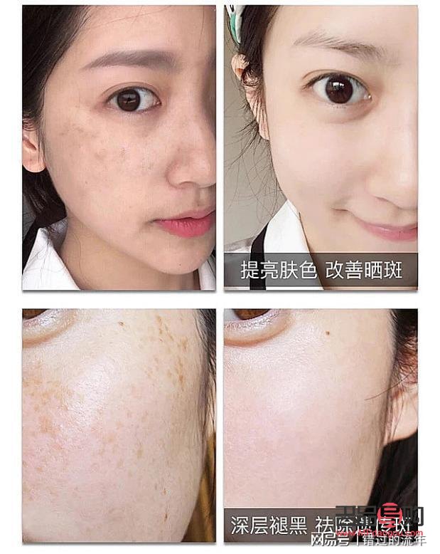 祛斑哪些美容院好(祛斑哪些美容院好点)