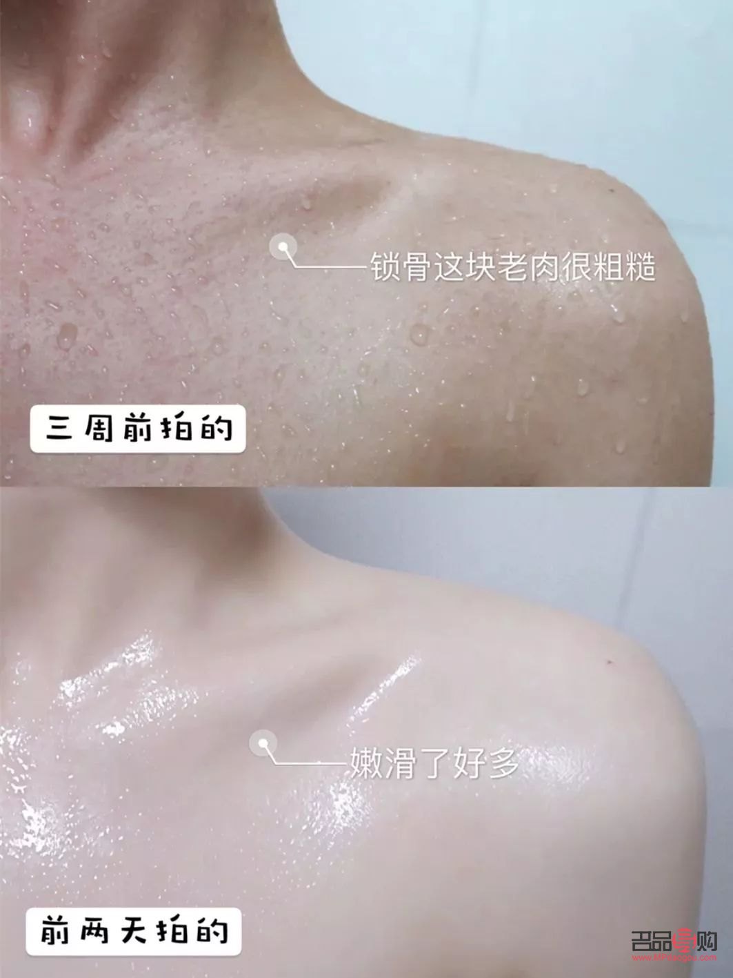 明星身体干燥怎么护理(明星身体干燥怎么护理好)