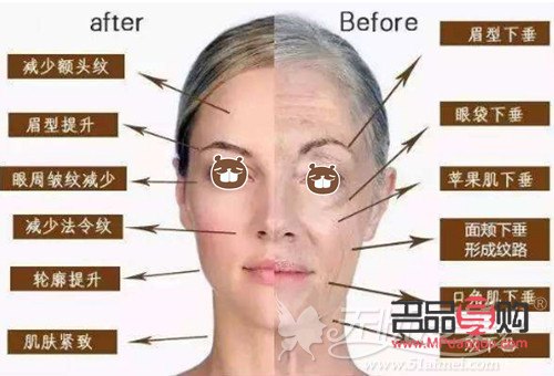 <h3>眼部超声炮的效果深度解析</h3>