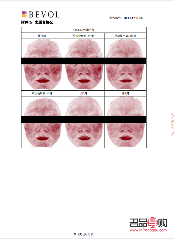 彩妆过敏测试全攻略：保障肌肤安全，美丽无忧