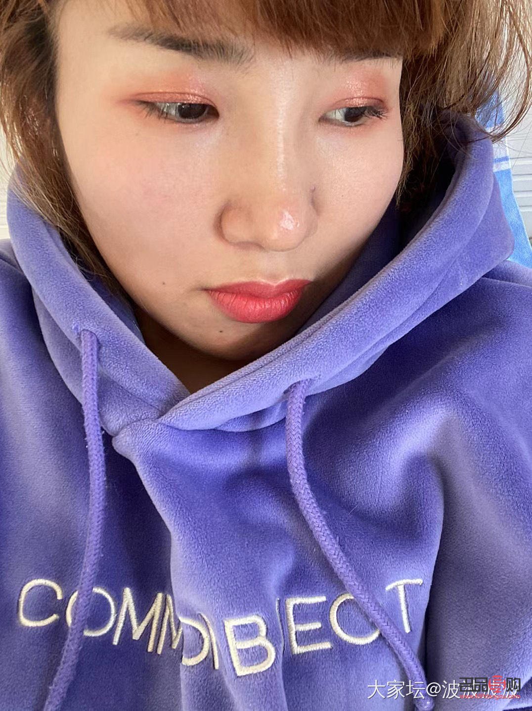 做双眼皮会有后遗症吗百度(做双眼皮会有后遗症吗百度知道)