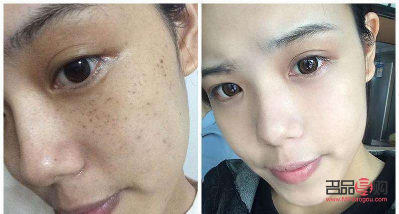 去斑美容哪里有效(去斑美容哪里有效果)