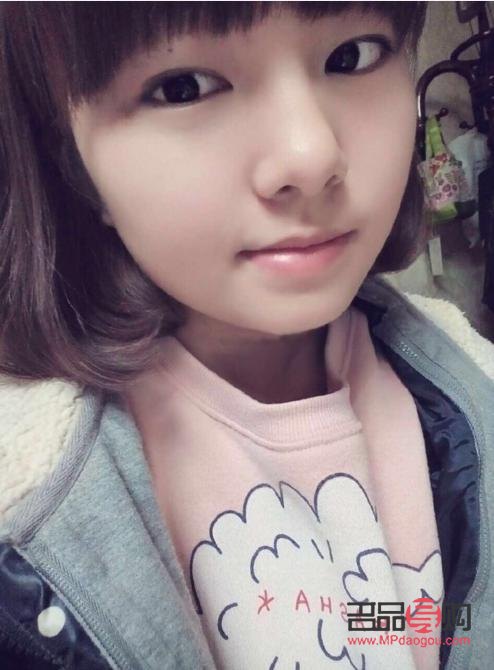 双眼皮8mm三个月后还没消肿(双眼皮8mm三个月后还没消肿正常吗)