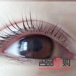 双眼皮翘睫手术原理详解