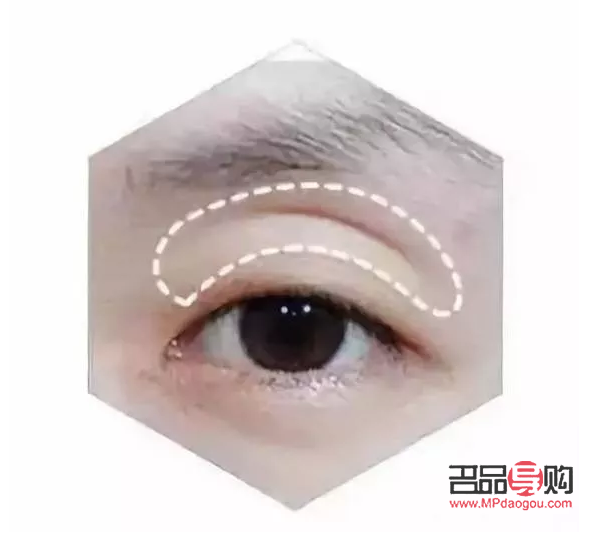 深眼窝和眼窝凹陷的区别(深眼窝和眼窝凹陷的区别图解)