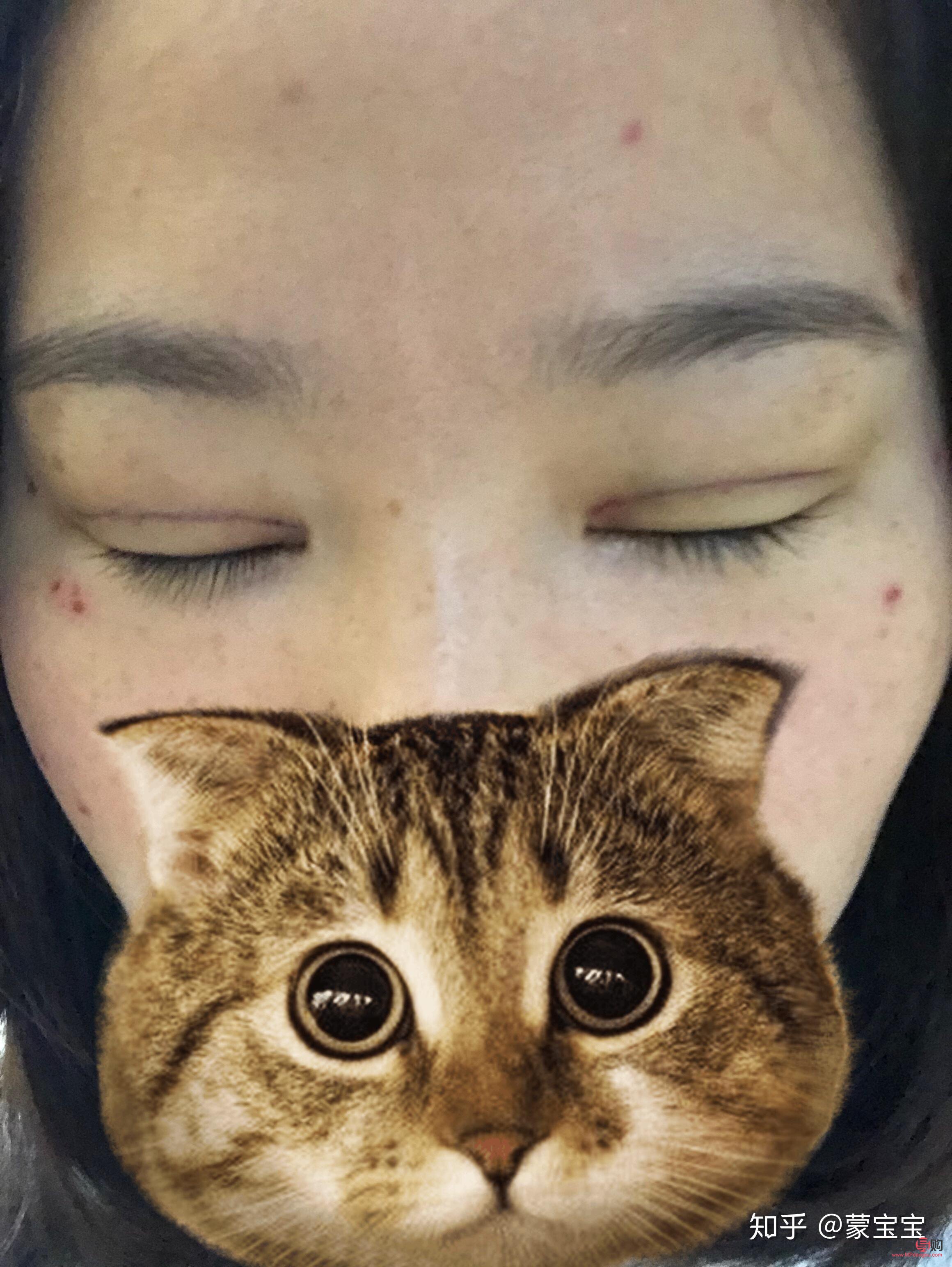 <h3>40岁做埋线双眼皮，效果能维持多久？</h3>