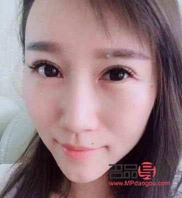 全切双眼皮包含几项(全切双眼皮包含几项手术)