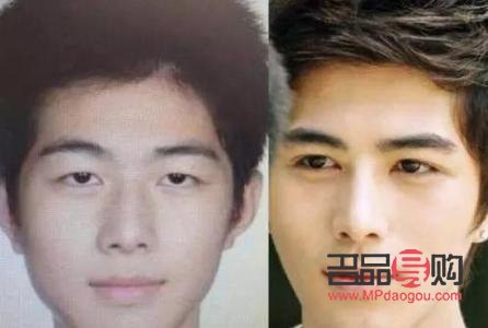 眼皮肌无力做双眼皮可以改善吗(眼皮肌无力做双眼皮可以改善吗图片)