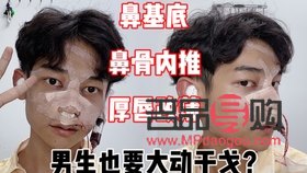 日式无痕双眼皮是什么原理(日式无痕双眼皮是什么原理做的)